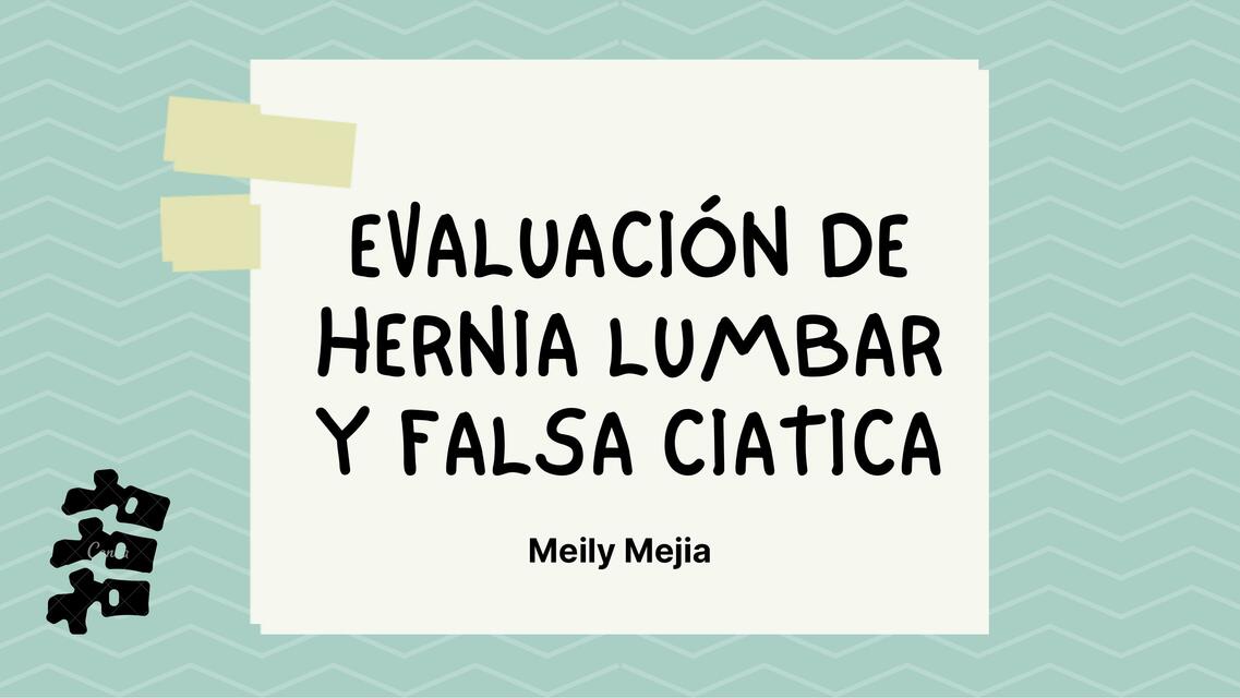 Hernia lumbar y Falsa ciática