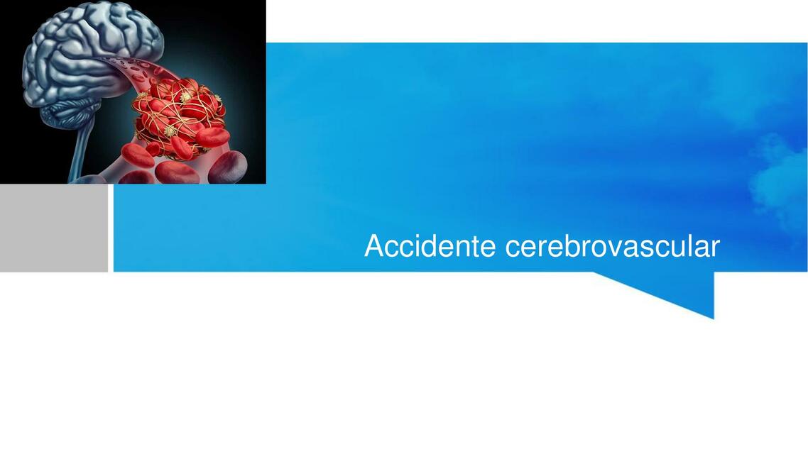 Accidente cerebrovascular 