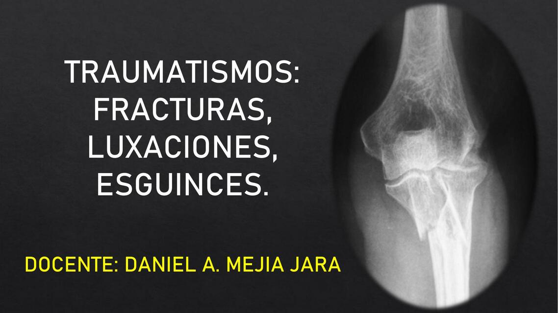 Traumatismo: Fracturas, Luxaciones, Esguinces 