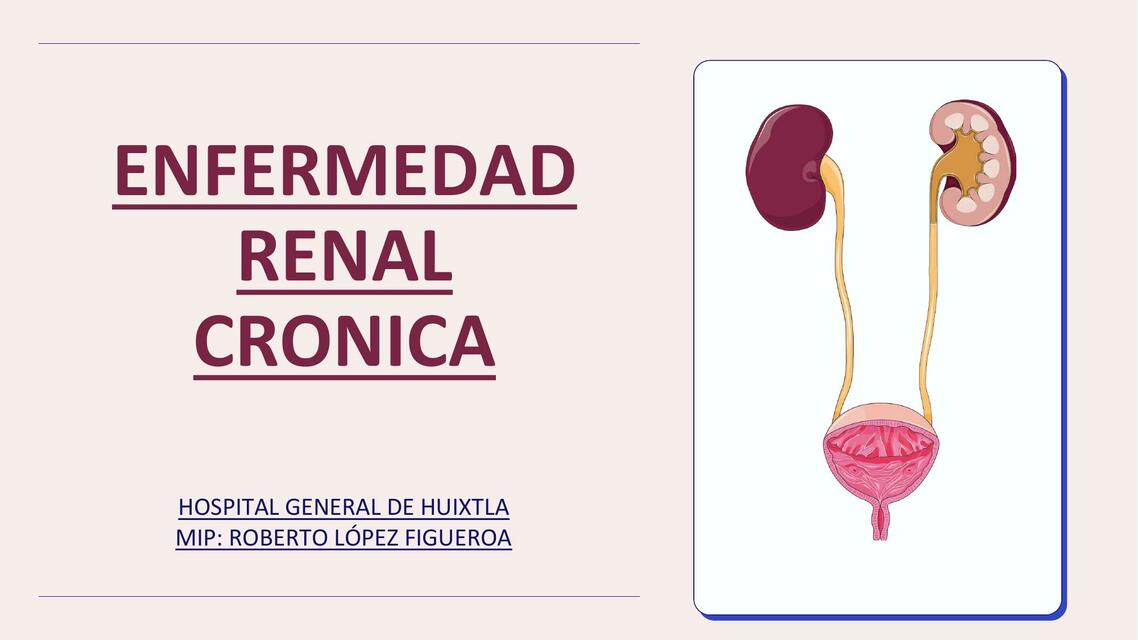 Enfermedad Renal Crónica 