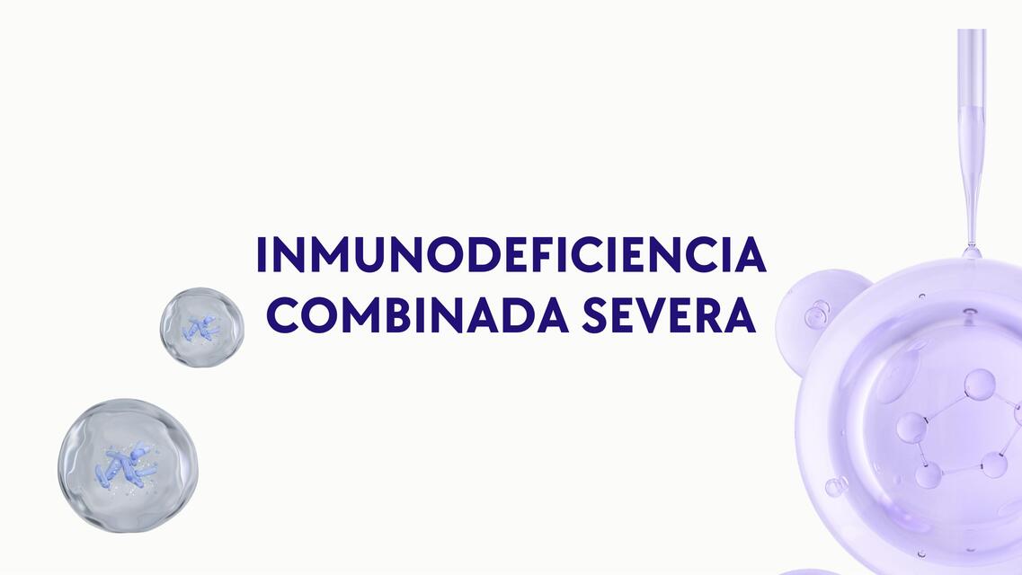 Inmunodeficiencia combinada severa 