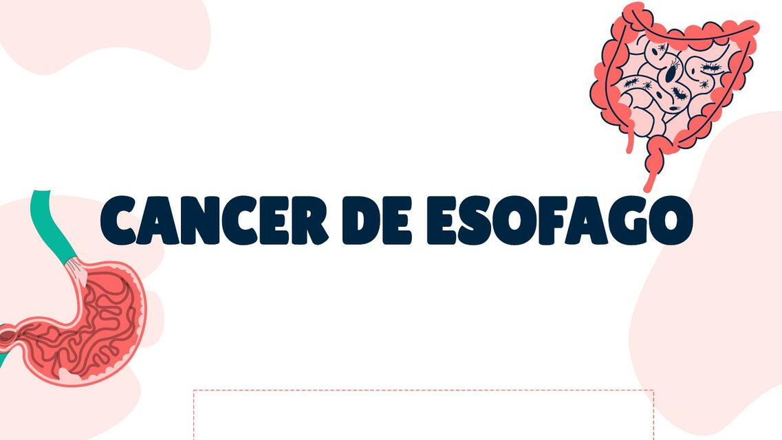 Cáncer de esofago