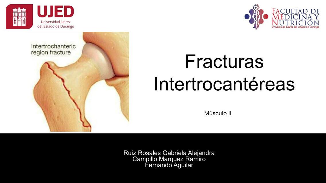 Fracturas Intertrocantéreas