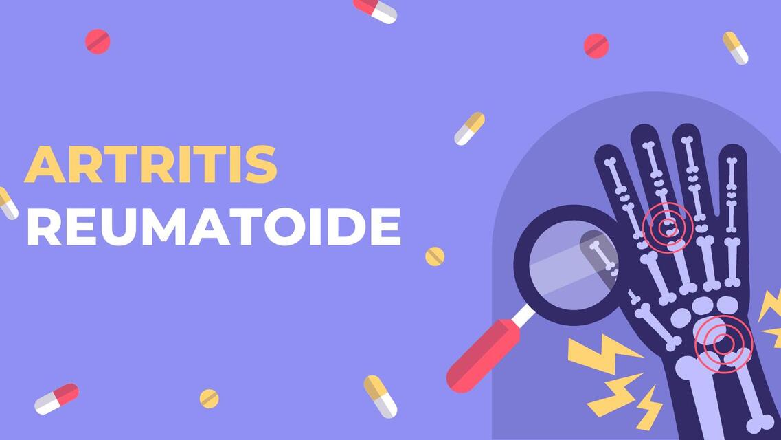 Artritis Reumatoide 