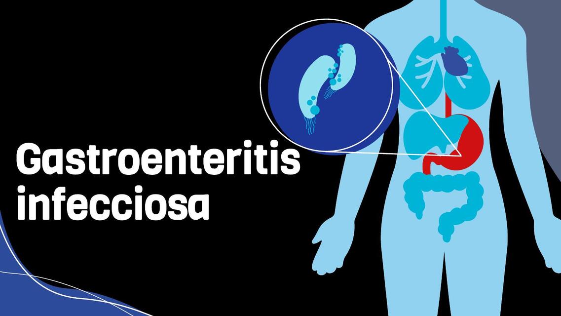 Gastroenteritis infecciosa 