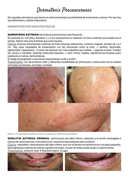 Dermatosis Precancerosas 