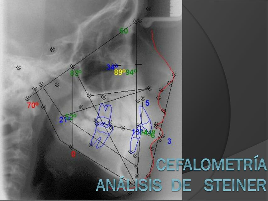 Cefalometría- Análisis de Steiner