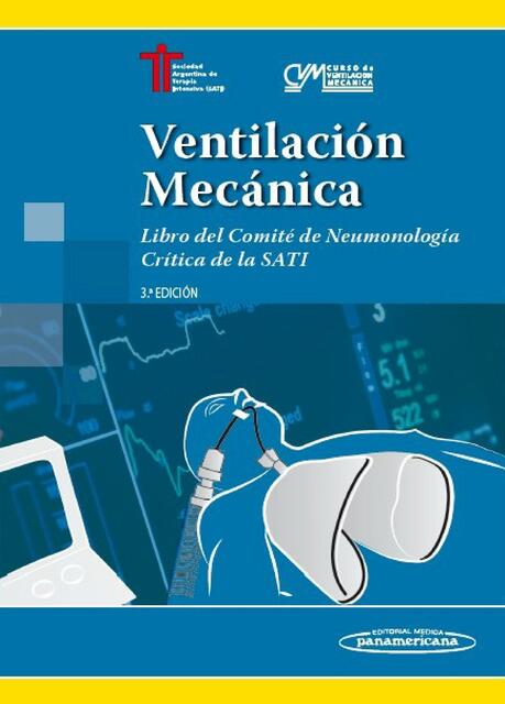 Ventilación Mecánica  