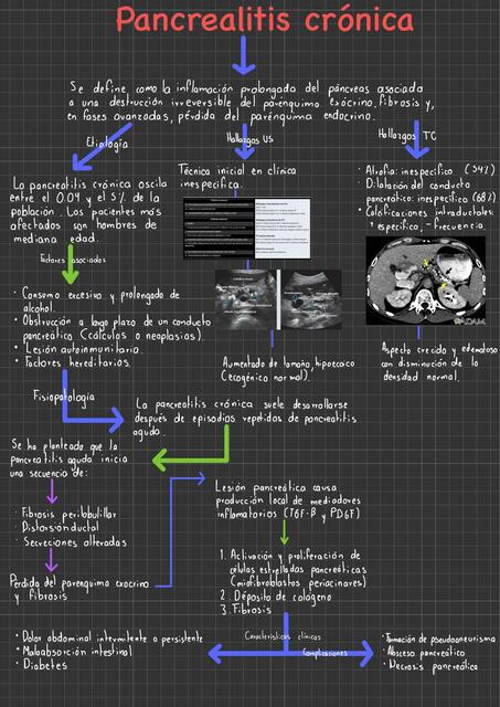 Pancreatitis crónica