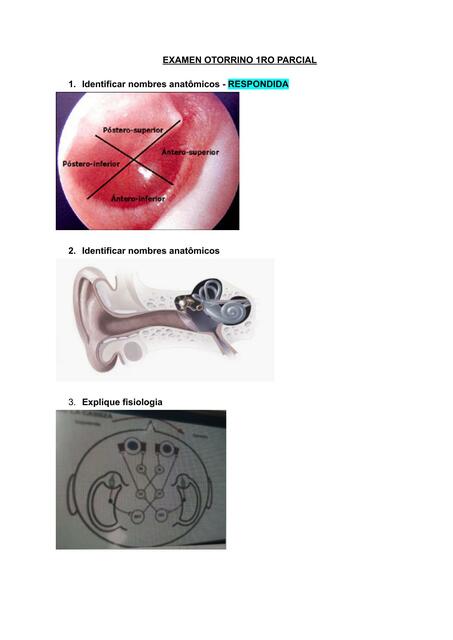 Examen Otorrino 1ro Parcial 