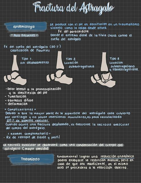 Fractura Del Astragalo