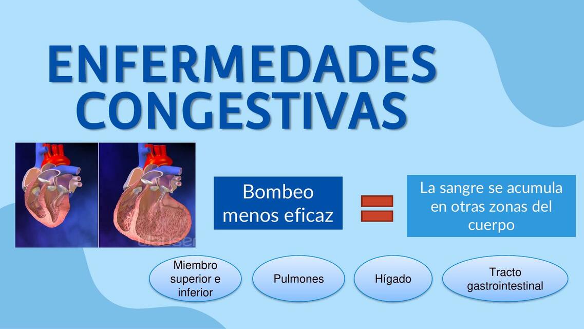 Insuficiencia cardiaca derecha 