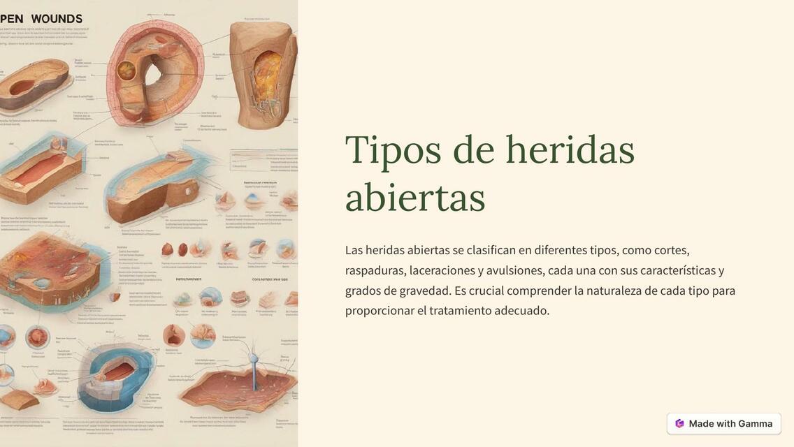 Tipos de Heridas Abiertas