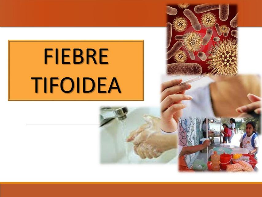 Fiebre tifoidea Felisa Ivania Gomez Garcia uDocz