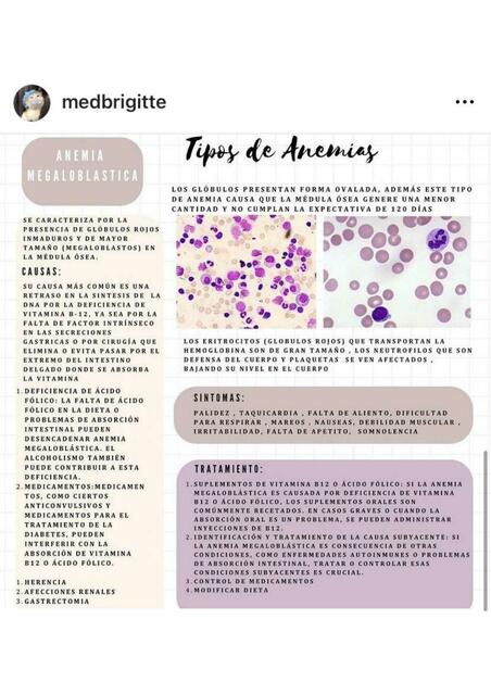 Anemia megaloblástica