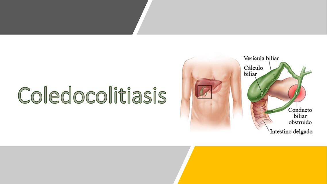 Coledocolitiasis y colecistitis 