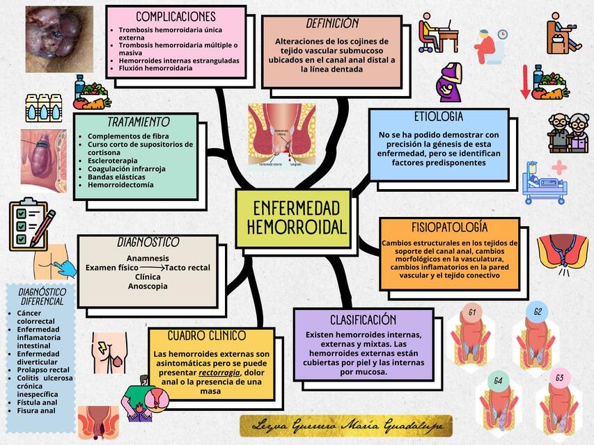 Enfermedad hemorroidal