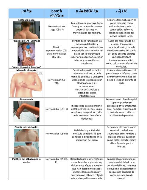 Lesiones en nervios