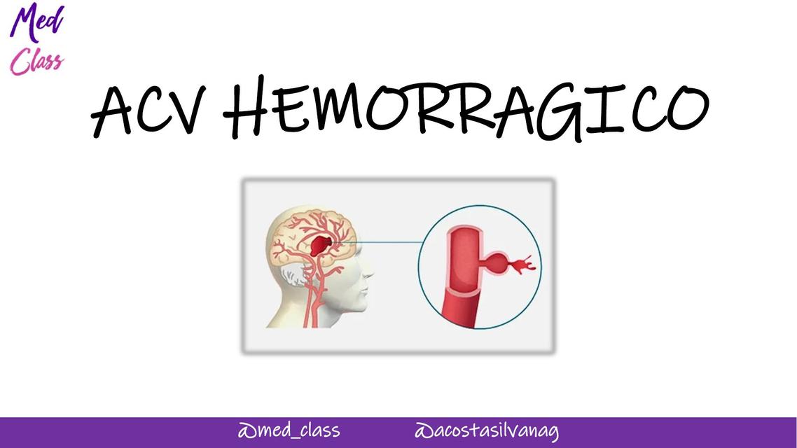 ACV HEMORRAGICO - MEDICINA INTERNA