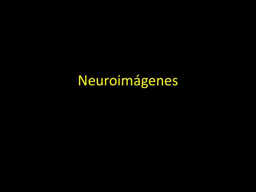 Neuroimágenes