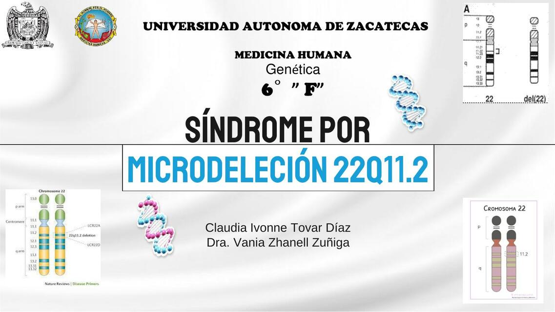 Síndrome por Microdeleción 22Q11.1 