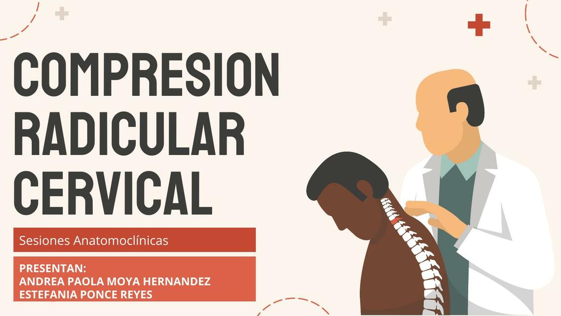 Compresión Radicular Cervical