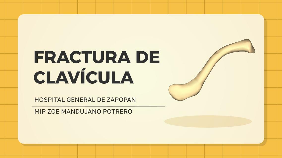 Fractura de clavícula | Zoe Mandujano Potrero | uDocz