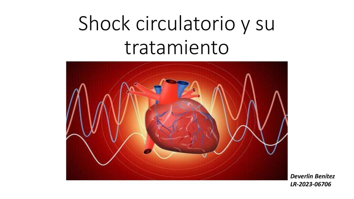 Shock circulatorio y su tratamiento 