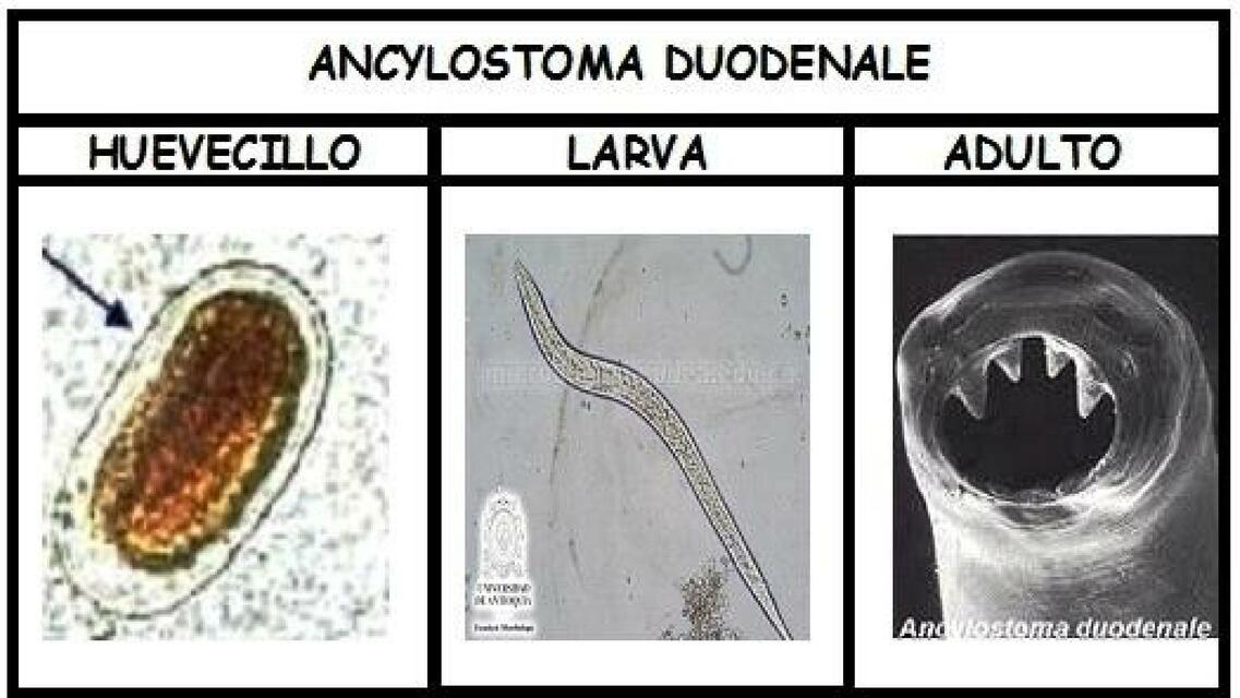 Parasitosis de Ancilostoma Duodenalis 