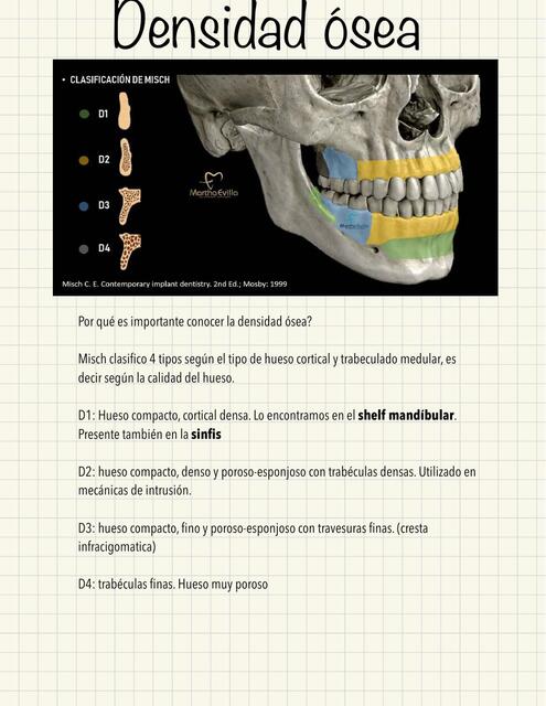 Densidad Ósea