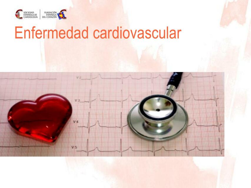 Enfermedad Cardiovascular