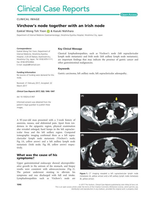 Virchow’s nodo together with Iris node | Angélica Mena | uDocz