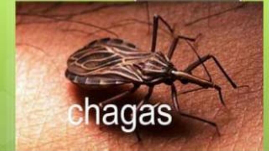 Enfermedad del Chagas 