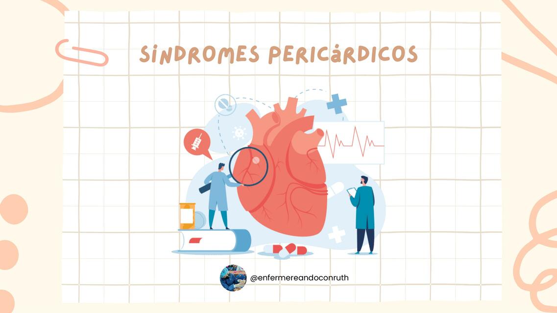 Síndromes Pericárdicos