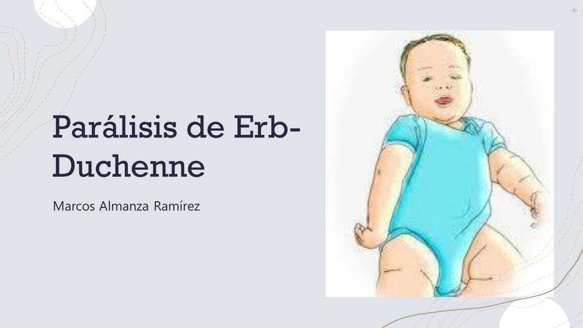 Parálisis de erb-duchenne | Jessy González | uDocz