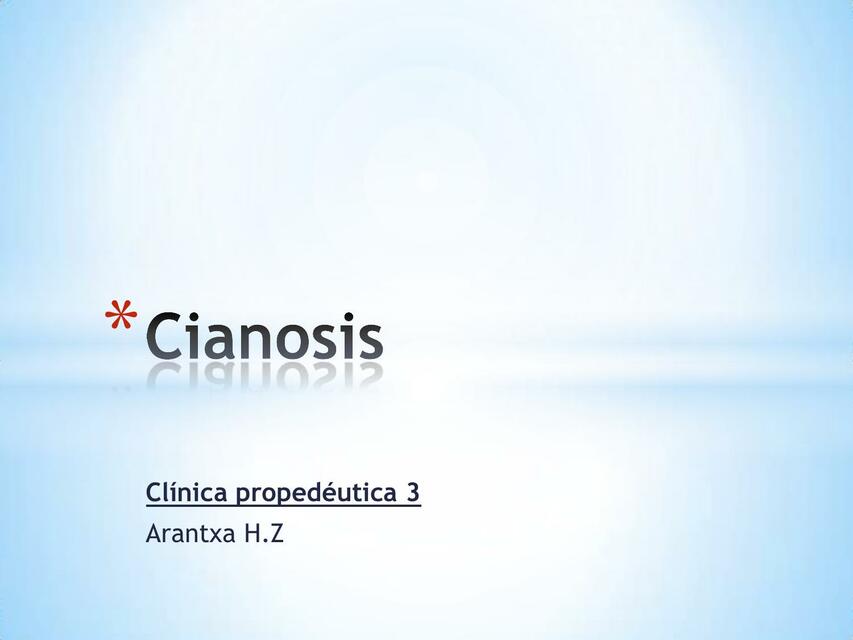 Cianosis 