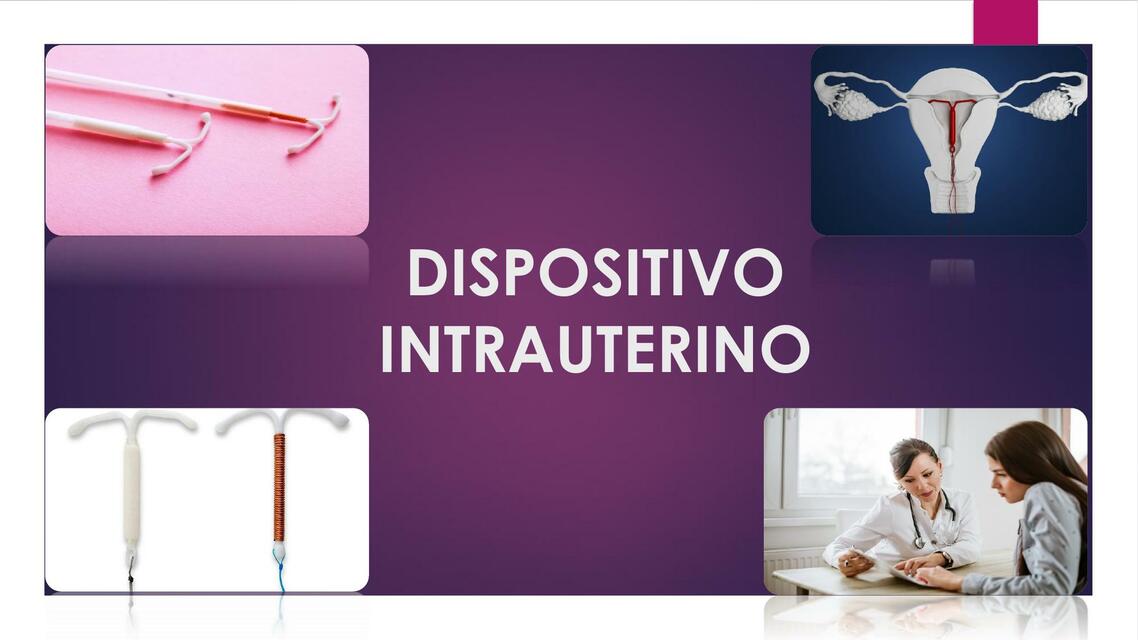 Dispositivo intrauterino 