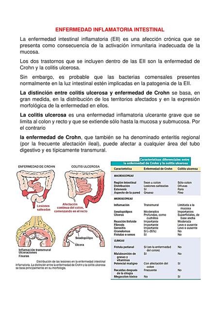 Enfermedad inflamatoria intestinal 