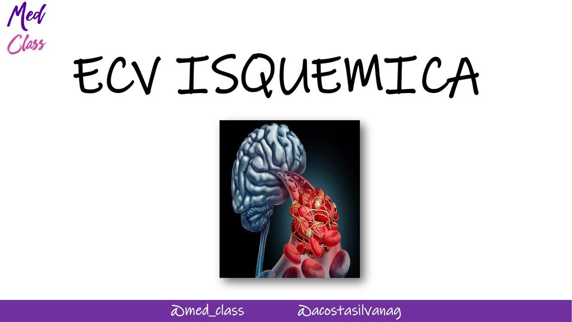 ACV ISQUEMICO