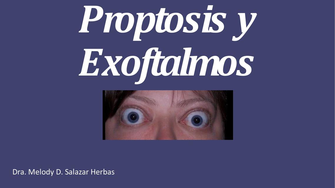 Proptosis y Exoftalmos 