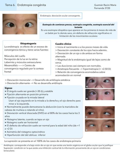 Endotropia Congénita | IOVANNY CRUZ OJEDA | uDocz