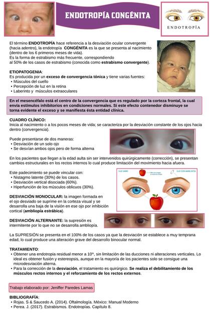 Endotropia Congénita | IOVANNY CRUZ OJEDA | uDocz