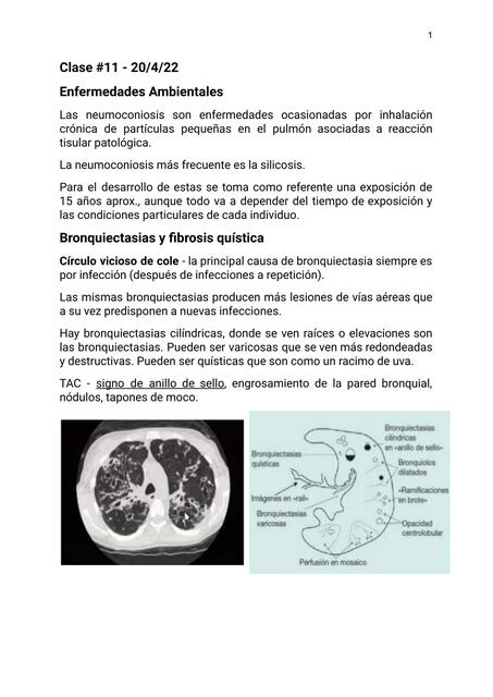 Tromboembolismo pulmonar