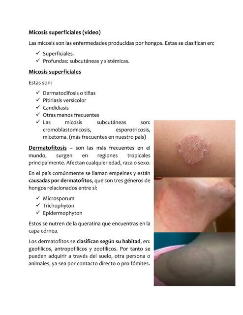 Micosis cutánea