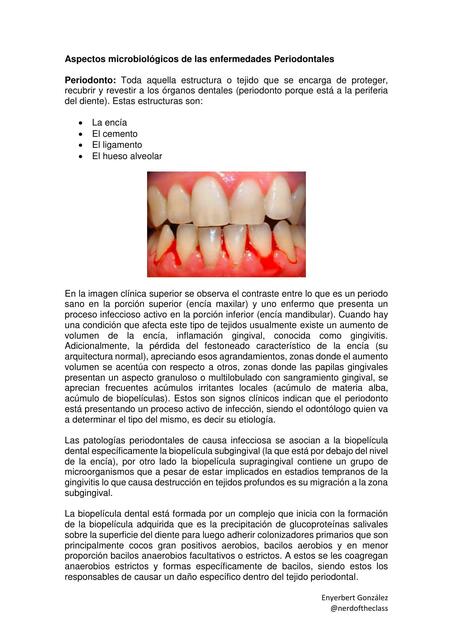 aspectos microbiológicos de las enfermedades Periodontales