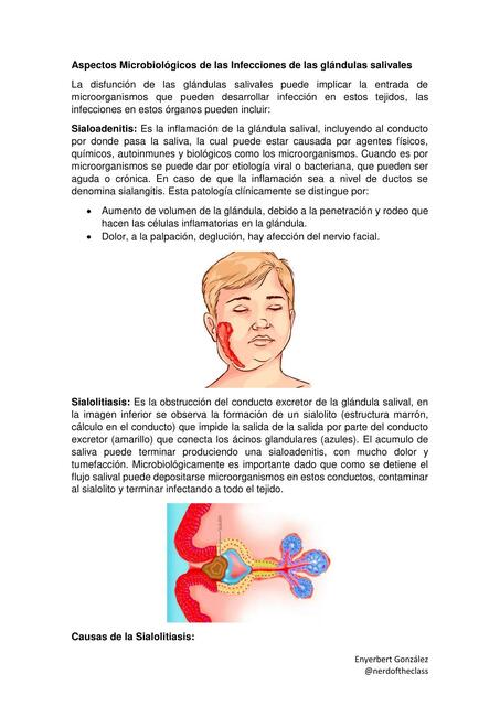 Aspectos Microbiológicos de las Infecciones de las Glándulas Salivales