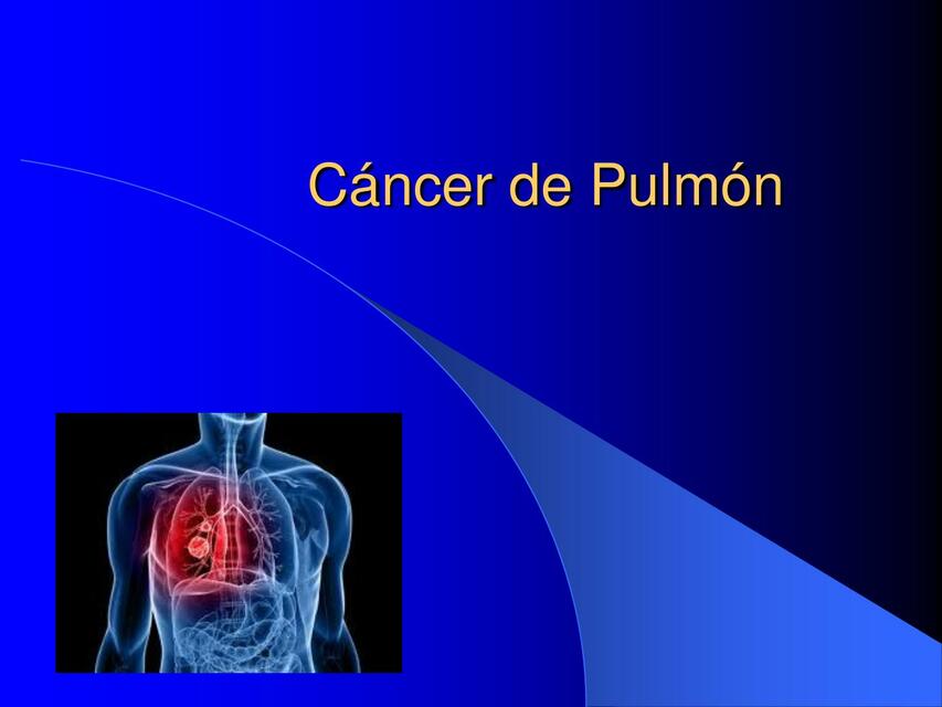 Cáncer de Pulmón 