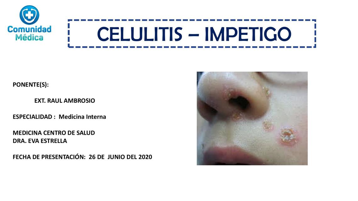 Enfermedades Infecciosas de la Piel (CELULITIS -IMPETIGO)