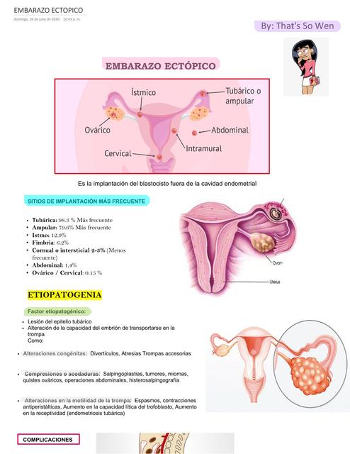 EMBARAZO ECTÓPICO (Ginecología y Obstetricia)