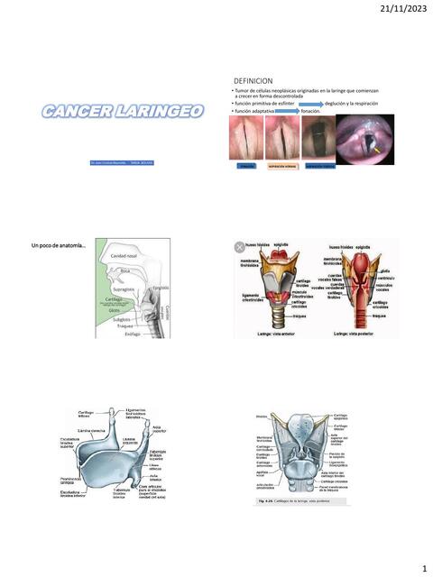 Cáncer laríngeo   